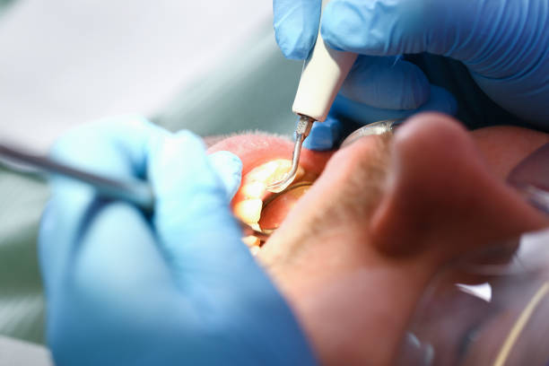Best Urgent Tooth Repair  in Barbourmeade, KY