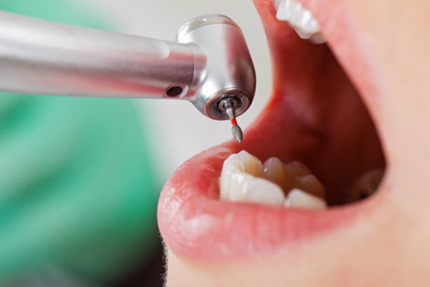 Best Broken Tooth Emergency  in Barbourmeade, KY